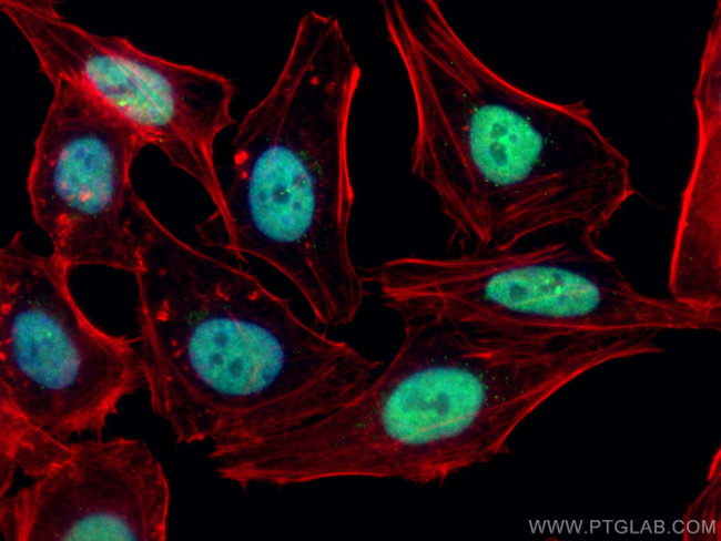 PCNA Antibody in Immunocytochemistry (ICC/IF)