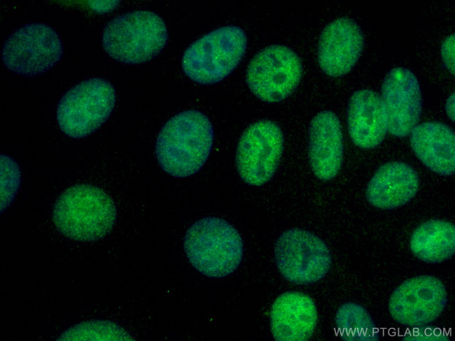 PCNA Antibody in Immunocytochemistry (ICC/IF)