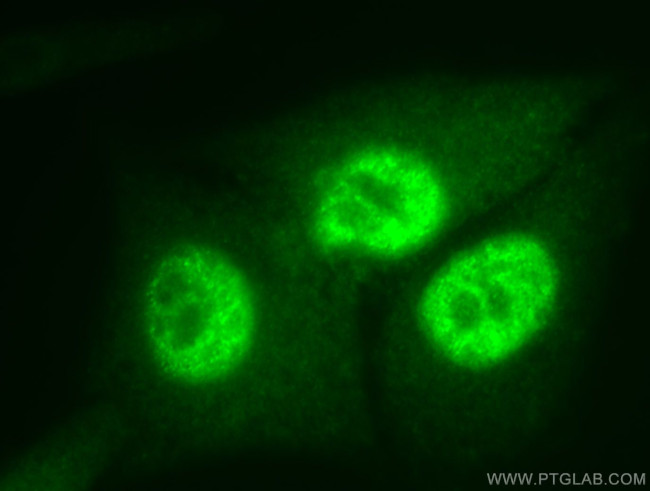 PCNA Antibody in Immunocytochemistry (ICC/IF)