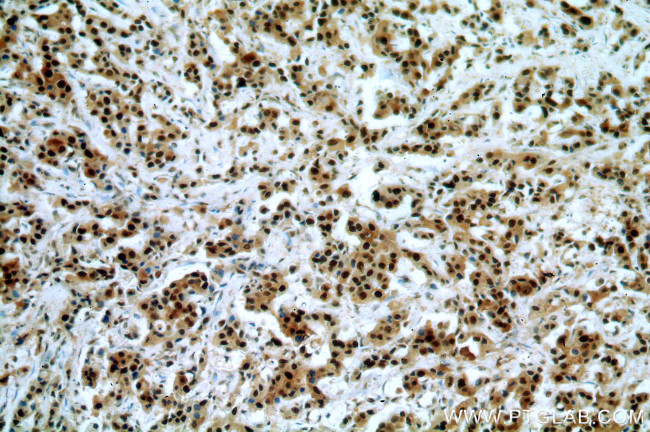 PCNA Antibody in Immunohistochemistry (Paraffin) (IHC (P))