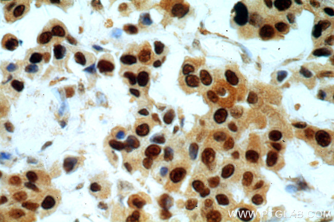 PCNA Antibody in Immunohistochemistry (Paraffin) (IHC (P))