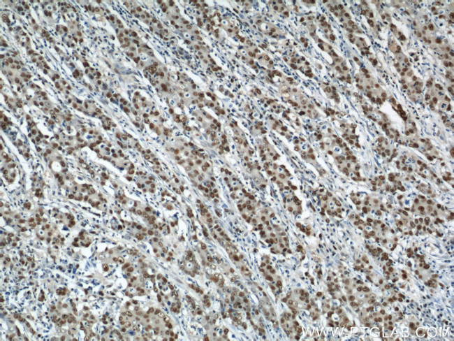 PCNA Antibody in Immunohistochemistry (Paraffin) (IHC (P))