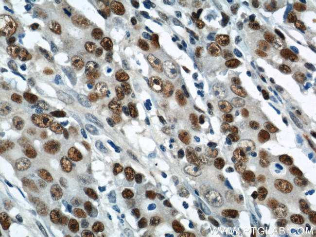 PCNA Antibody in Immunohistochemistry (Paraffin) (IHC (P))