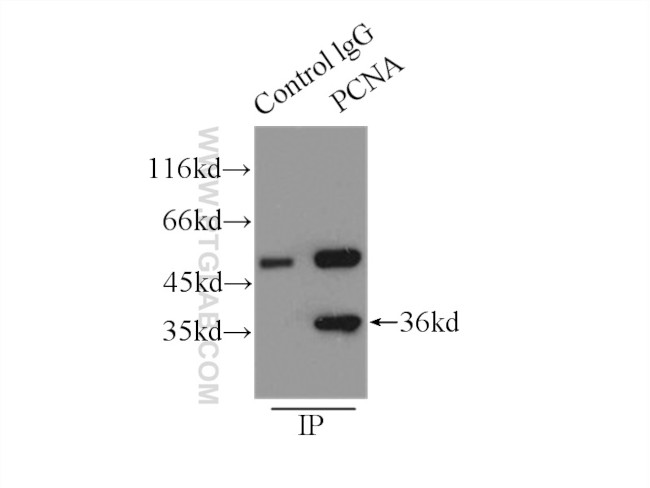 PCNA Antibody in Immunoprecipitation (IP)