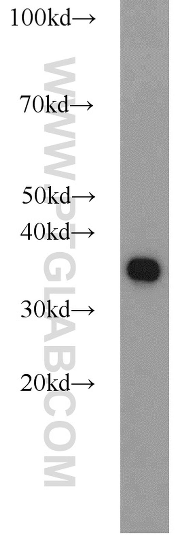 PCNA Antibody in Western Blot (WB)