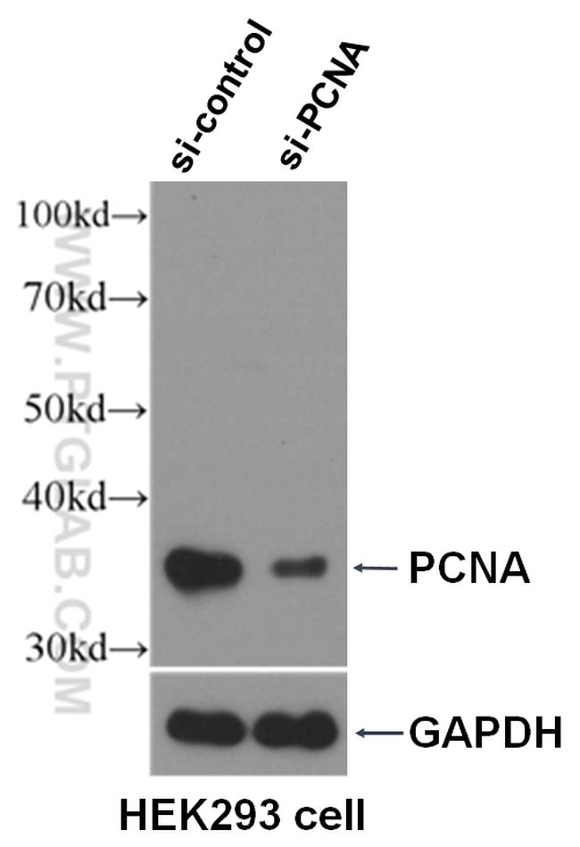 PCNA Antibody in Western Blot (WB)