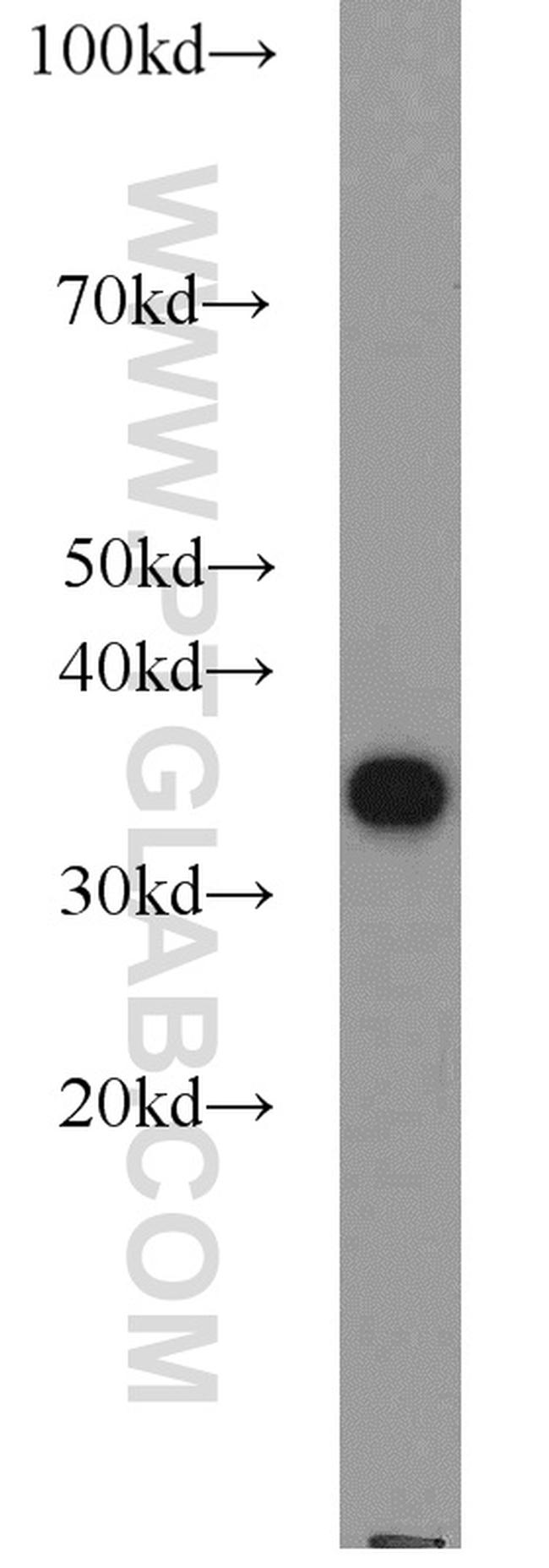 PCNA Antibody in Western Blot (WB)