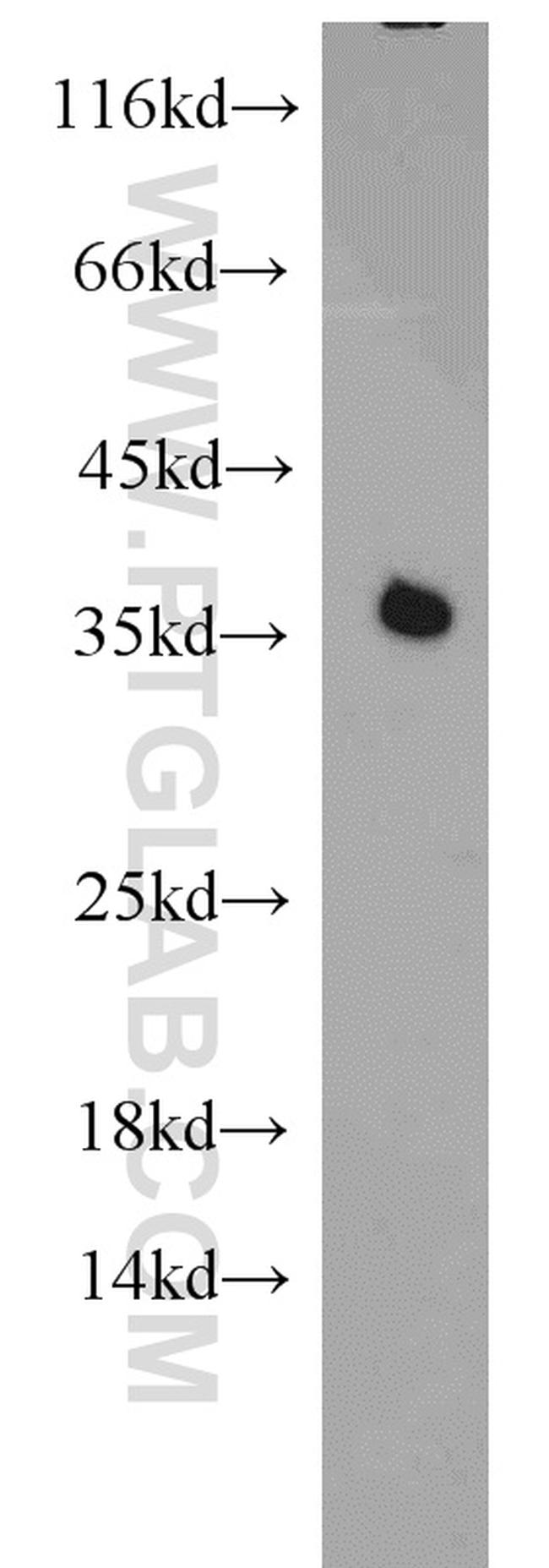 PCNA Antibody in Western Blot (WB)