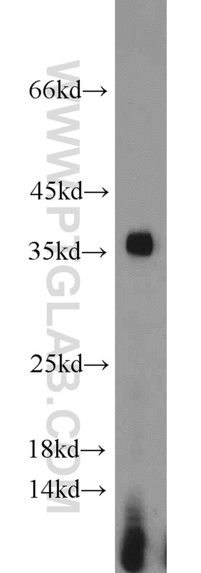 PCNA Antibody in Western Blot (WB)