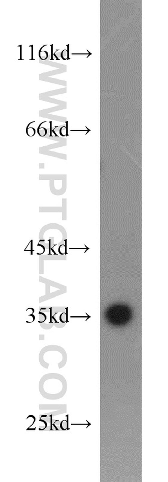 PCNA Antibody in Western Blot (WB)