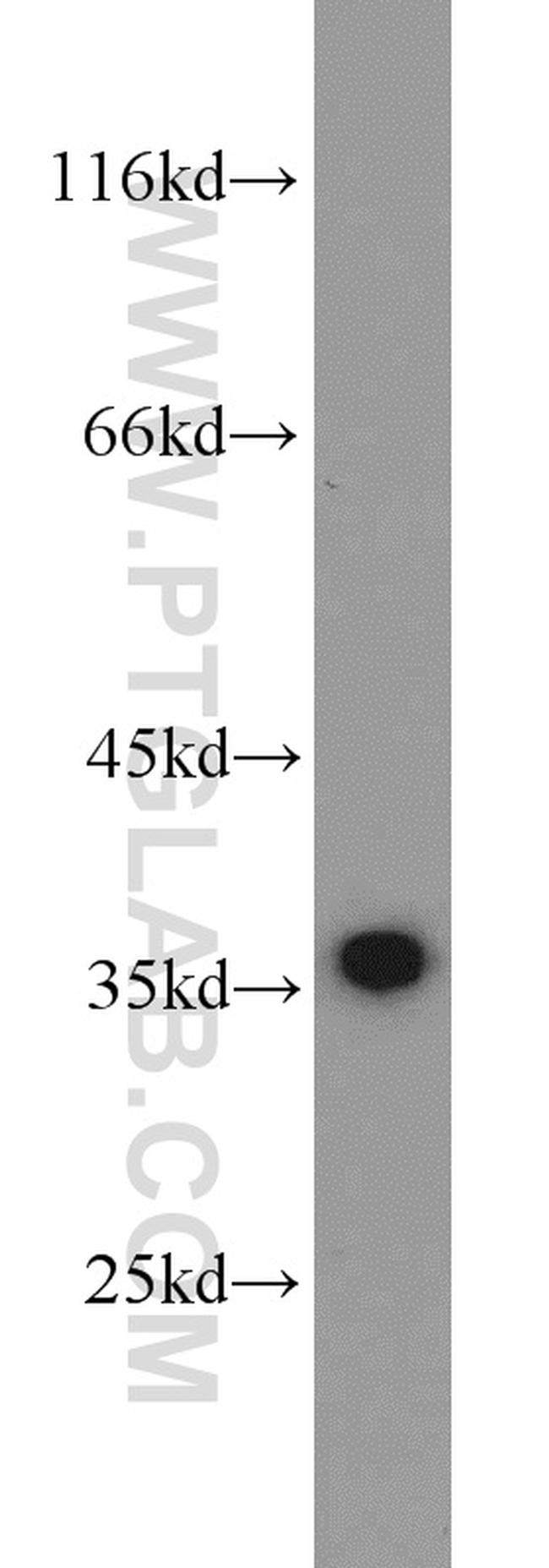 PCNA Antibody in Western Blot (WB)