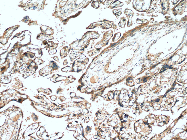 NCK2 Antibody in Immunohistochemistry (Paraffin) (IHC (P))