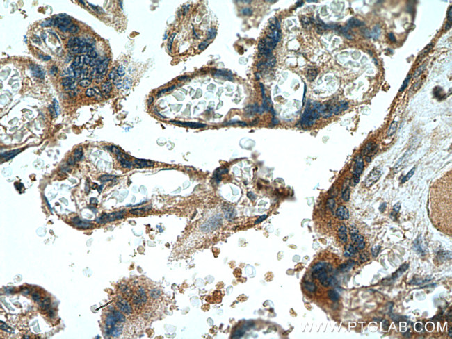 NCK2 Antibody in Immunohistochemistry (Paraffin) (IHC (P))