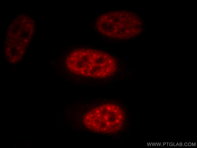 EFTUD2 Antibody in Immunocytochemistry (ICC/IF)