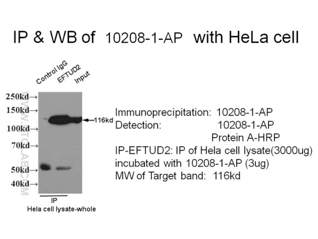 EFTUD2 Antibody in Immunoprecipitation (IP)