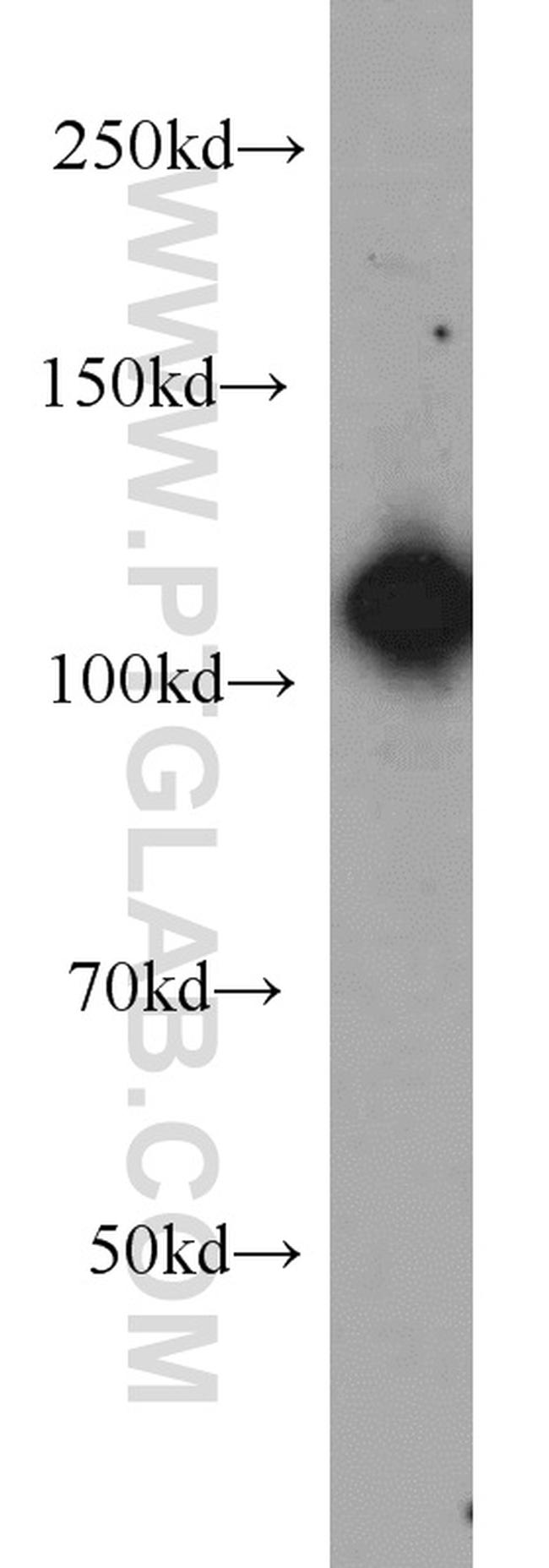 EFTUD2 Antibody in Western Blot (WB)