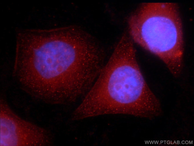 CIRBP Antibody in Immunocytochemistry (ICC/IF)