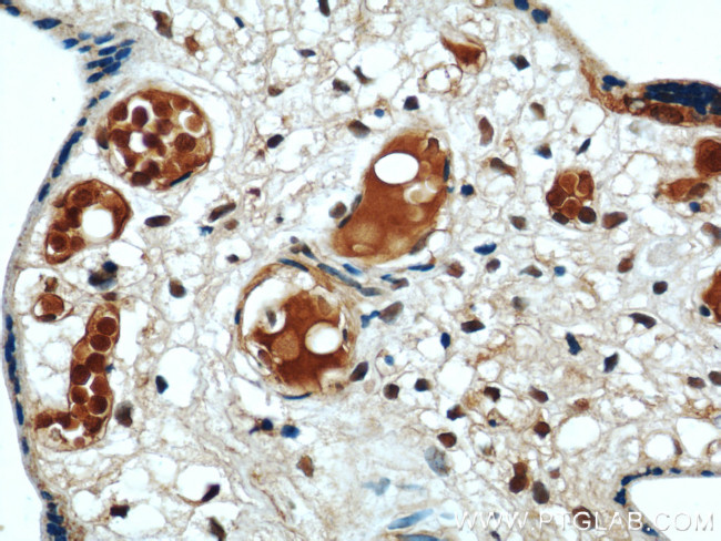 CIRBP Antibody in Immunohistochemistry (Paraffin) (IHC (P))