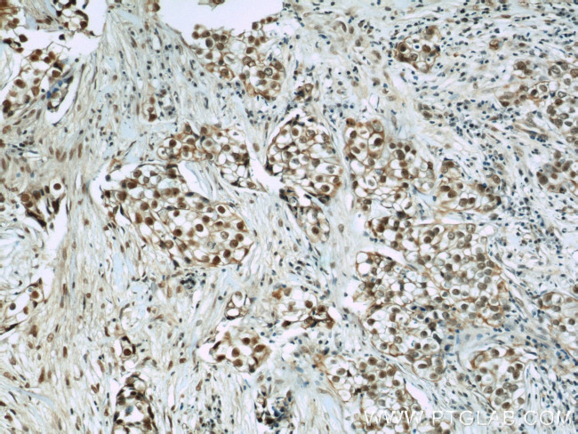 CIRBP Antibody in Immunohistochemistry (Paraffin) (IHC (P))