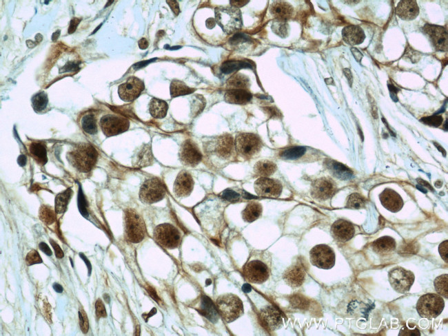 CIRBP Antibody in Immunohistochemistry (Paraffin) (IHC (P))