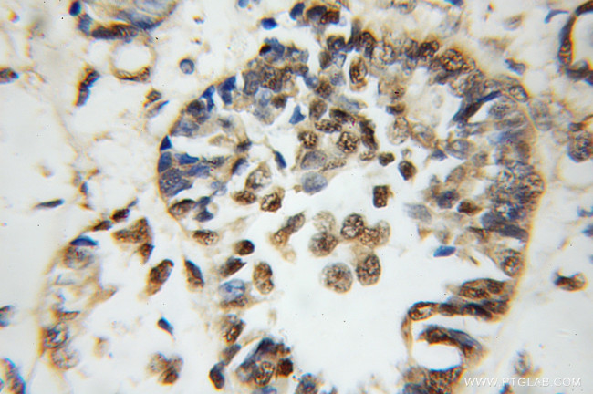 CIRBP Antibody in Immunohistochemistry (Paraffin) (IHC (P))