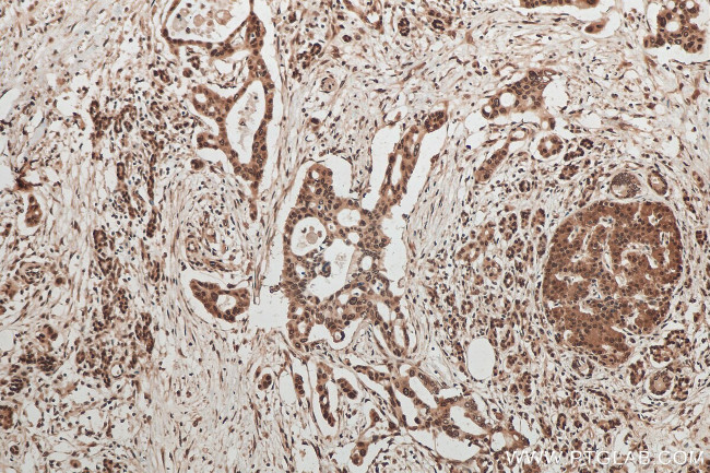 CIRBP Antibody in Immunohistochemistry (Paraffin) (IHC (P))