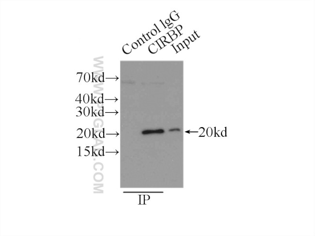 CIRBP Antibody in Immunoprecipitation (IP)
