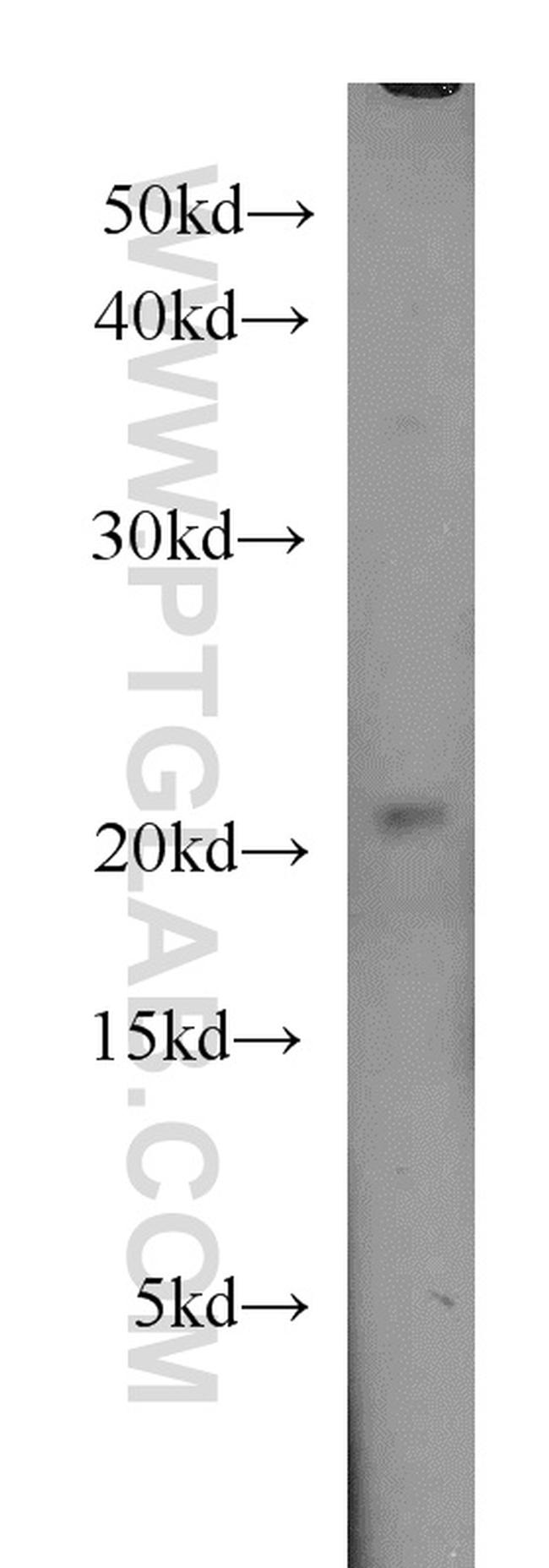 CIRBP Antibody in Western Blot (WB)