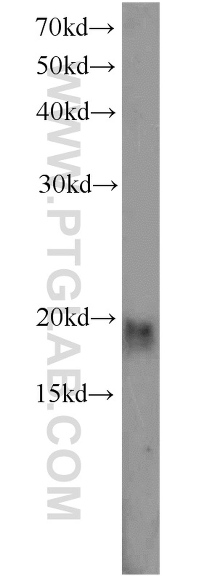 CIRBP Antibody in Western Blot (WB)