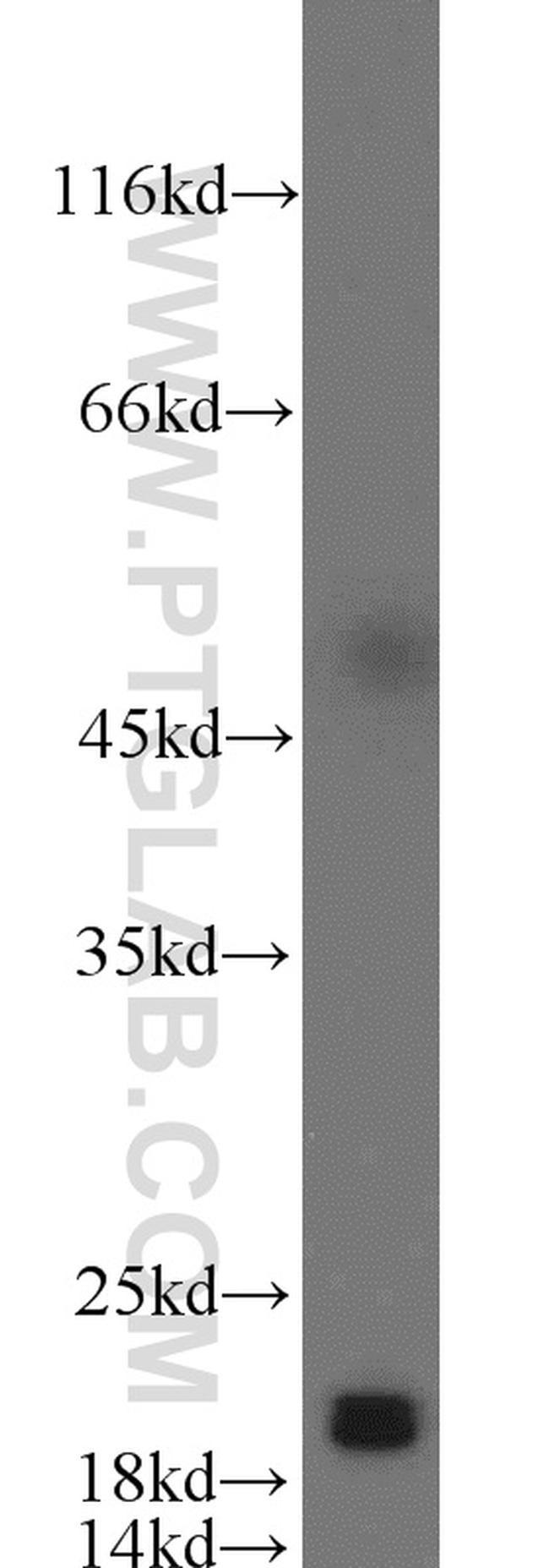 CIRBP Antibody in Western Blot (WB)