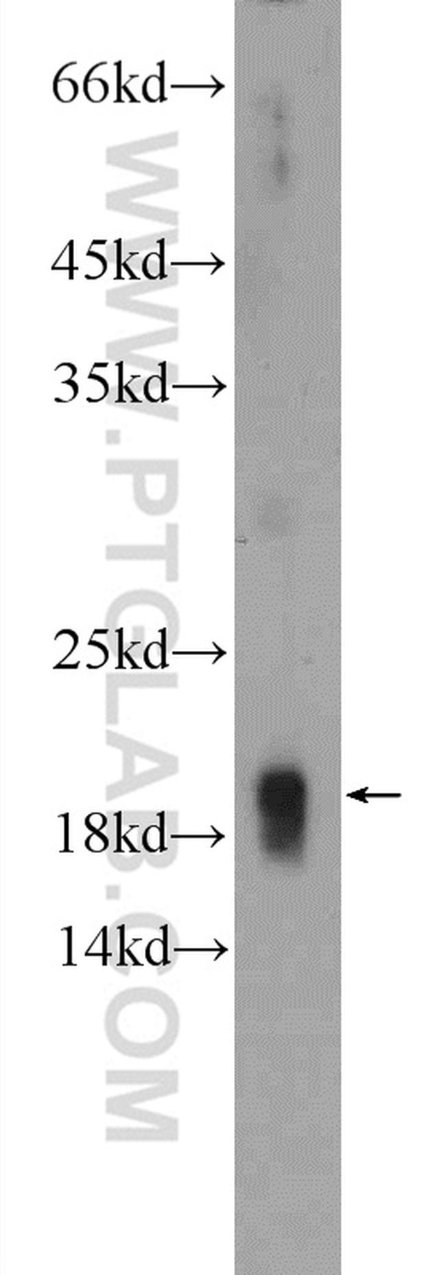 CIRBP Antibody in Western Blot (WB)