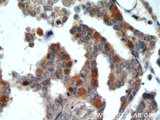 RUVBL1 Antibody in Immunohistochemistry (Paraffin) (IHC (P))