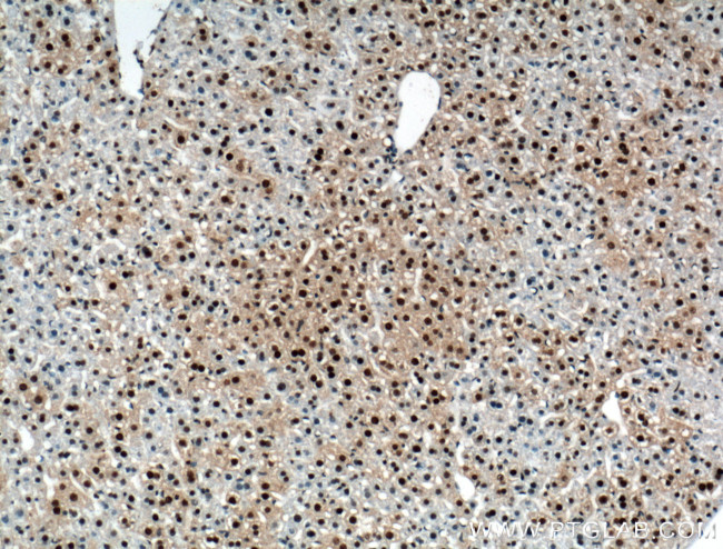 RUVBL1 Antibody in Immunohistochemistry (Paraffin) (IHC (P))