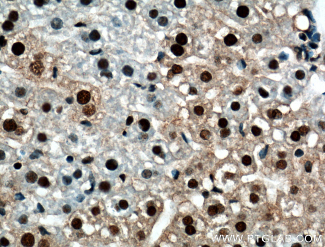 RUVBL1 Antibody in Immunohistochemistry (Paraffin) (IHC (P))