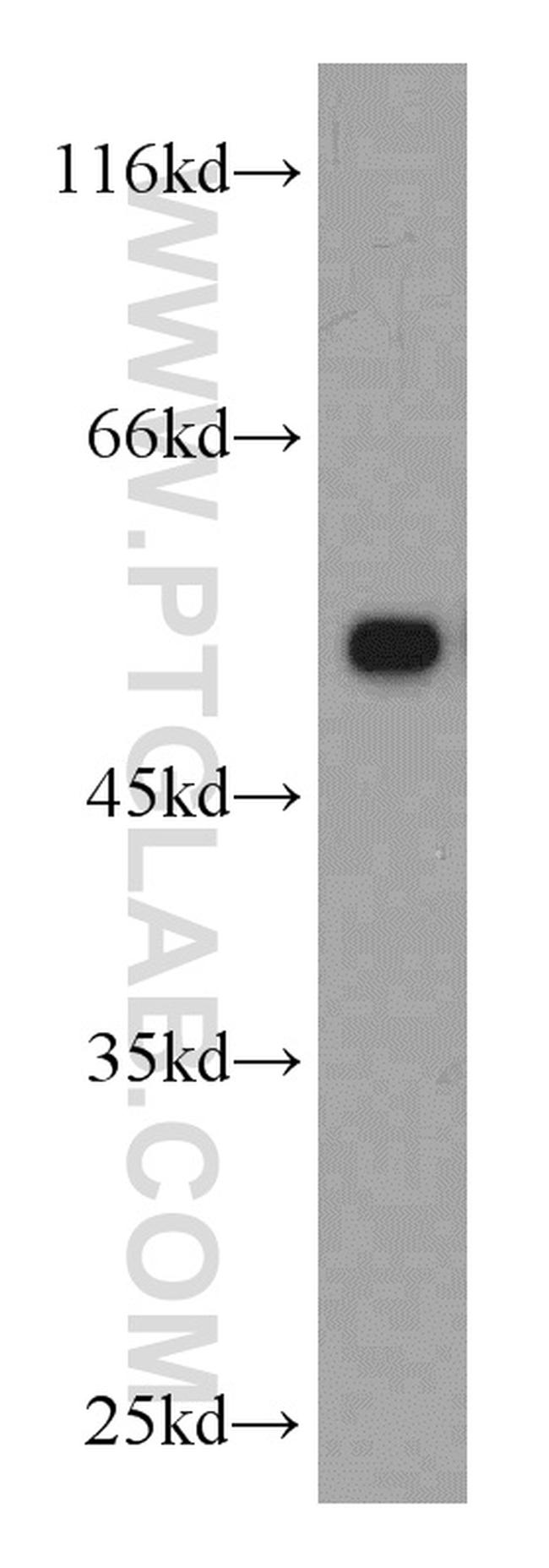 RUVBL1 Antibody in Western Blot (WB)