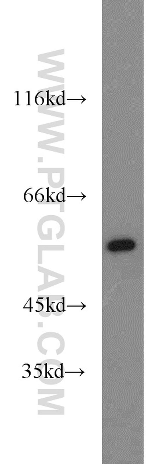 RUVBL1 Antibody in Western Blot (WB)