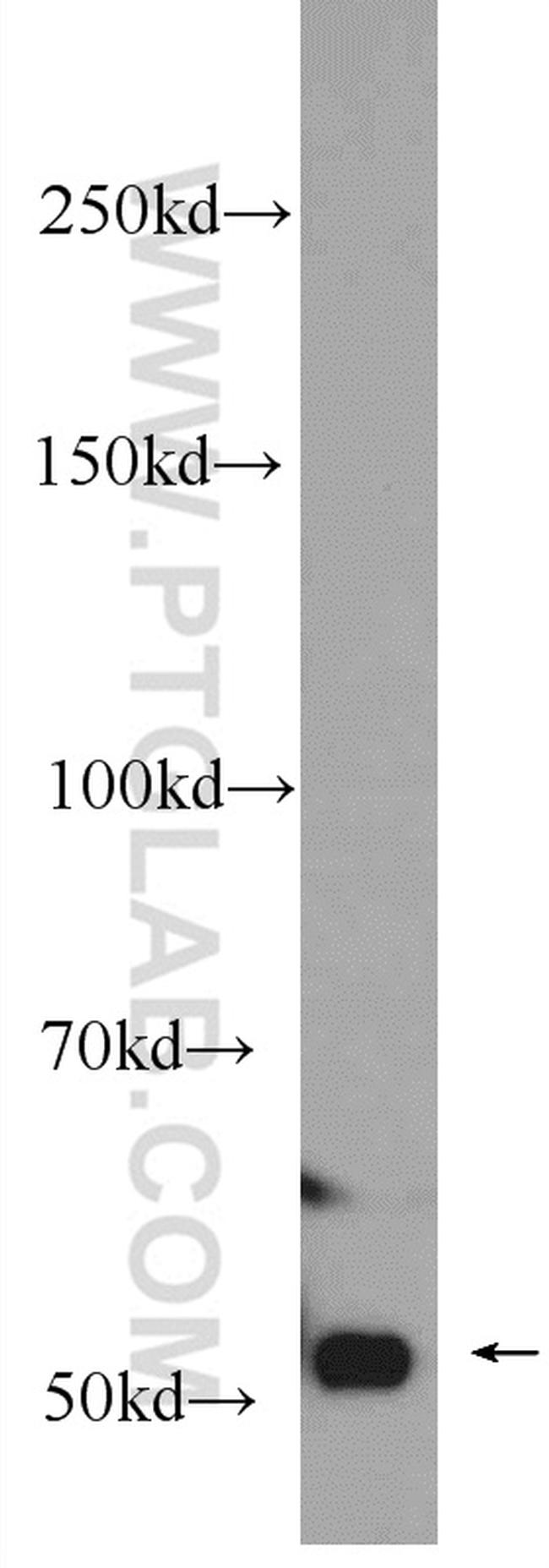 RUVBL1 Antibody in Western Blot (WB)