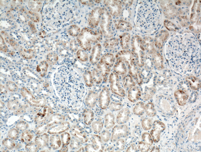 HSPBP1 Antibody in Immunohistochemistry (Paraffin) (IHC (P))