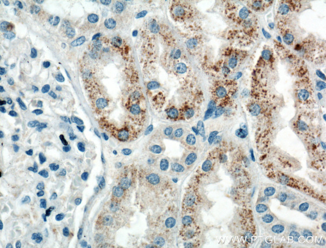 HSPBP1 Antibody in Immunohistochemistry (Paraffin) (IHC (P))