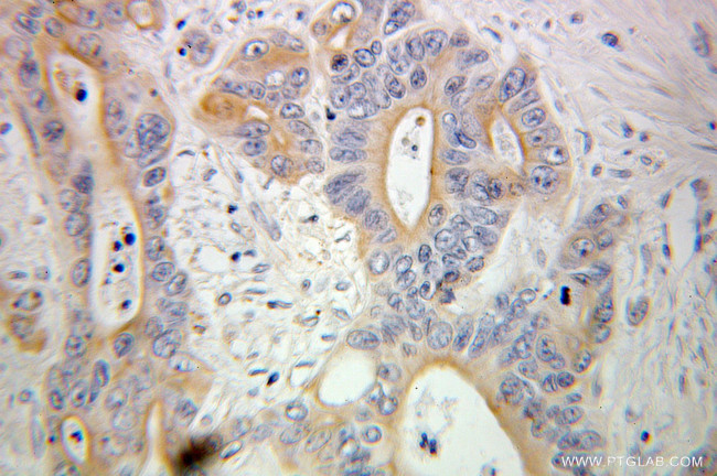 HSPBP1 Antibody in Immunohistochemistry (Paraffin) (IHC (P))