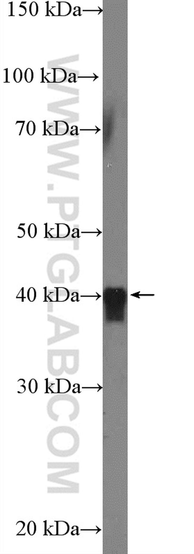 HSPBP1 Antibody in Western Blot (WB)