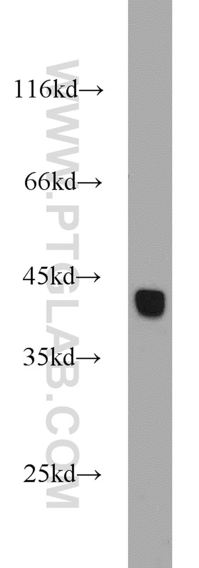 HSPBP1 Antibody in Western Blot (WB)