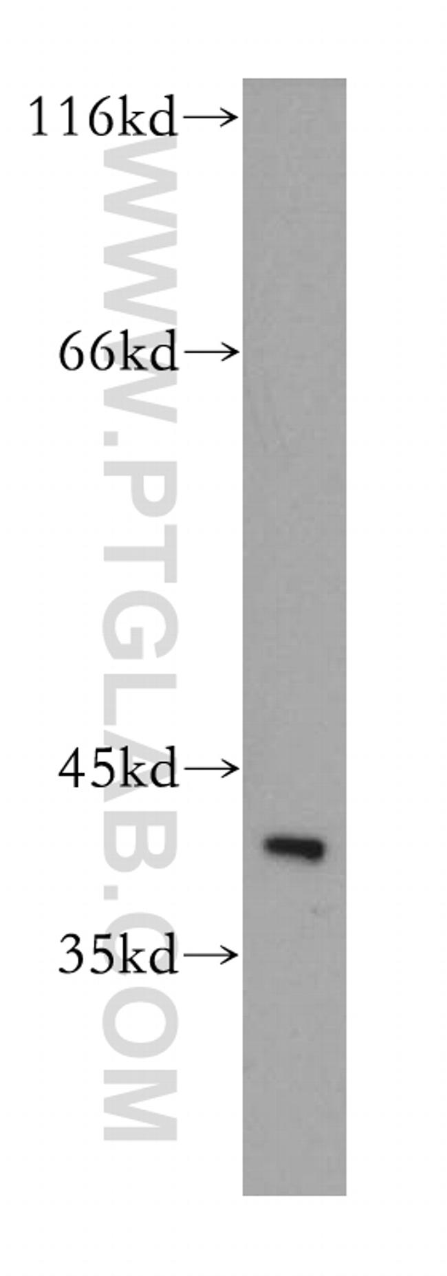 HSPBP1 Antibody in Western Blot (WB)