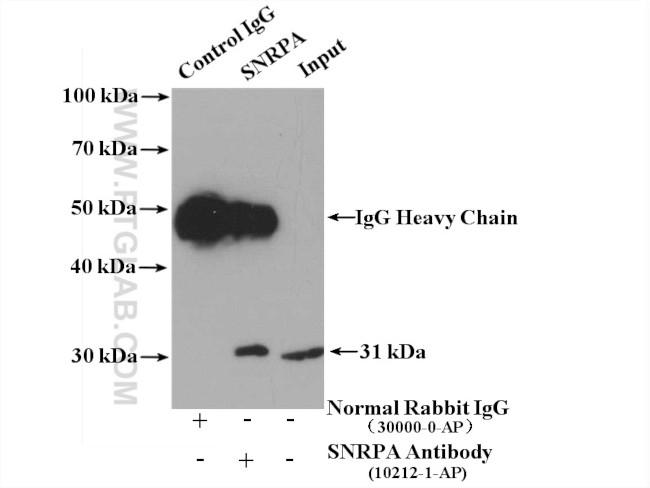 SNRPA Antibody in Immunoprecipitation (IP)