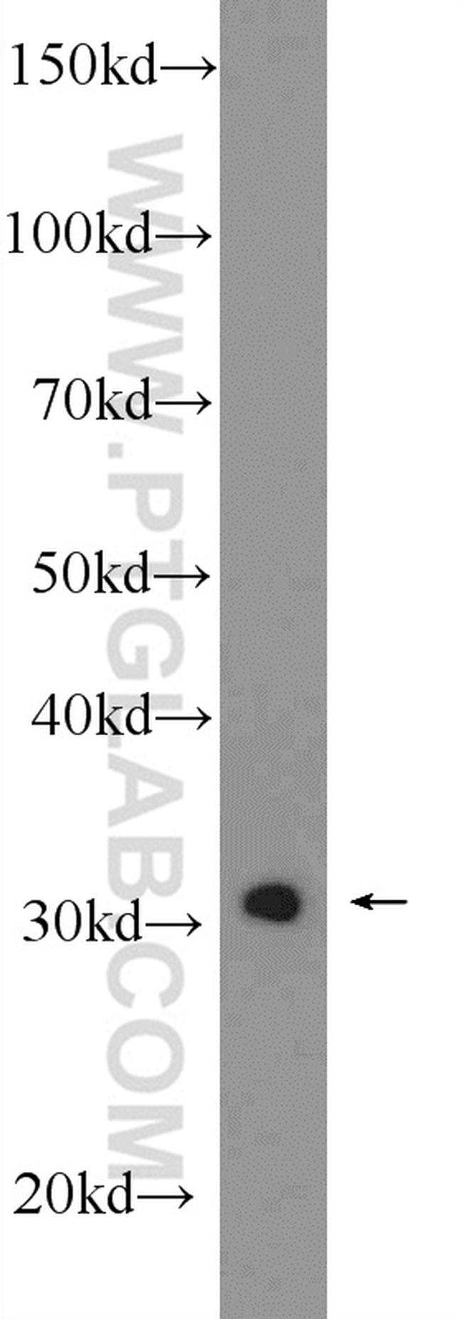 SNRPA Antibody in Western Blot (WB)