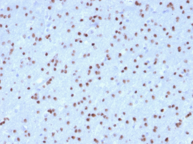 OLIG2 (Marker of Glial Brain Tumors) Antibody in Immunohistochemistry (Paraffin) (IHC (P))