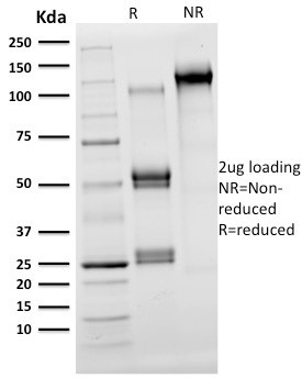 OLIG2 (Marker of Glial Brain Tumors) Antibody in SDS-PAGE (SDS-PAGE)