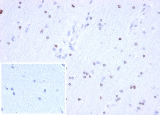 OLIG2 (Marker of Glial Brain Tumors) Antibody in Immunohistochemistry (Paraffin) (IHC (P))