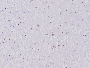 OLIG2 (Marker of Glial Brain Tumors) Antibody in Immunohistochemistry (Paraffin) (IHC (P))