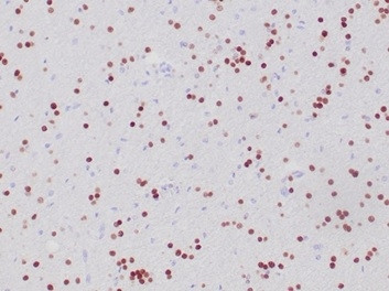 OLIG2 (Marker of Glial Brain Tumors) Antibody in Immunohistochemistry (Paraffin) (IHC (P))